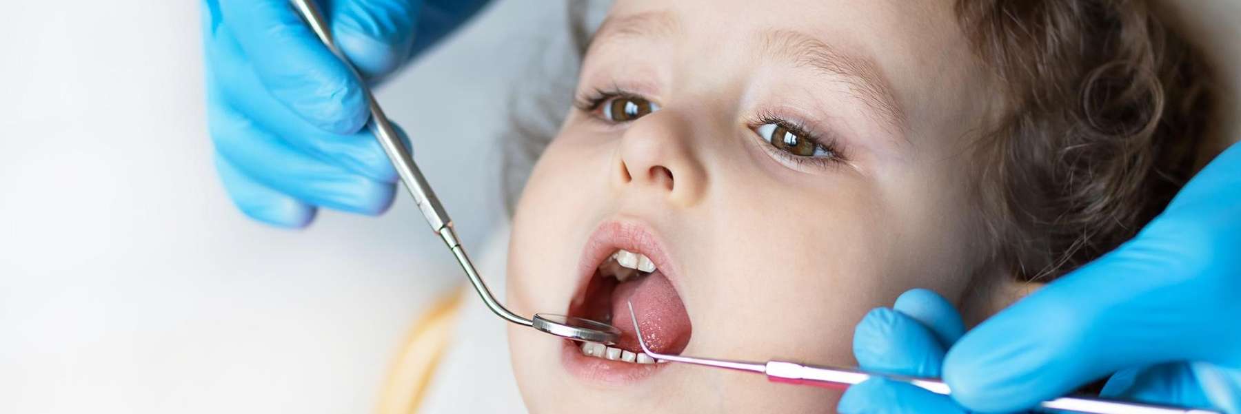 Cleaning and Examination | Dentist
